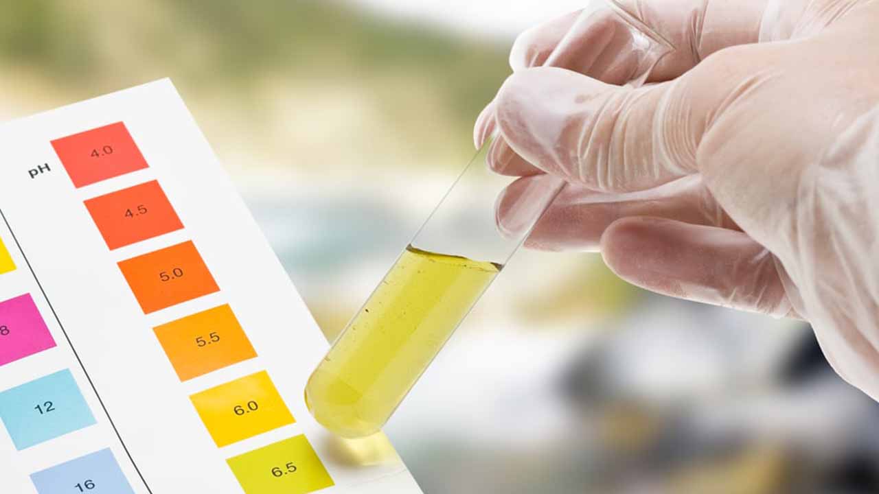 pH Regülasyonu Yönetimi